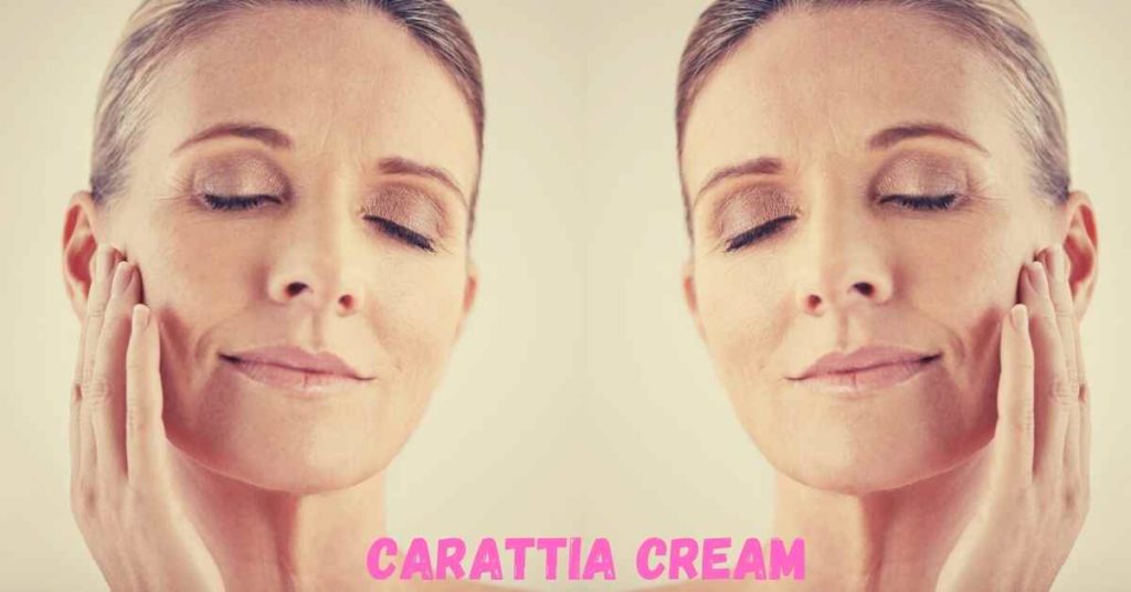 Carattia Cream vélemények